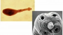 Łańcuch karwy i heminolepidoza